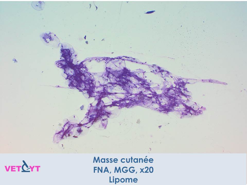 Cytologie-lipome