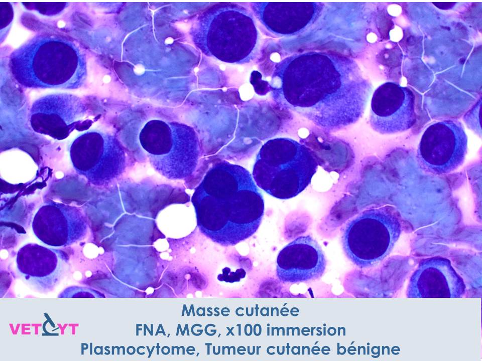 cytologie-plasmocytome