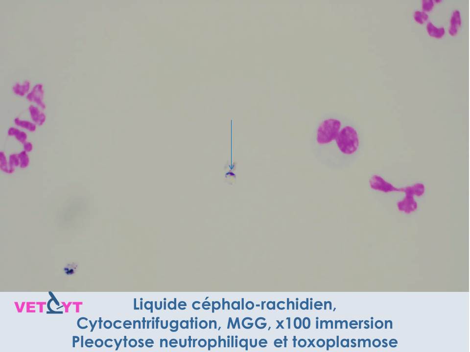 cytologie-toxoplasmose