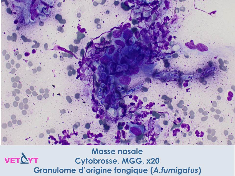cytologie-aspergillose
