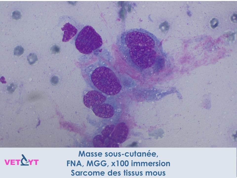 cytologie-sarcome