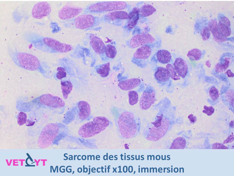 cytologie-sarcome