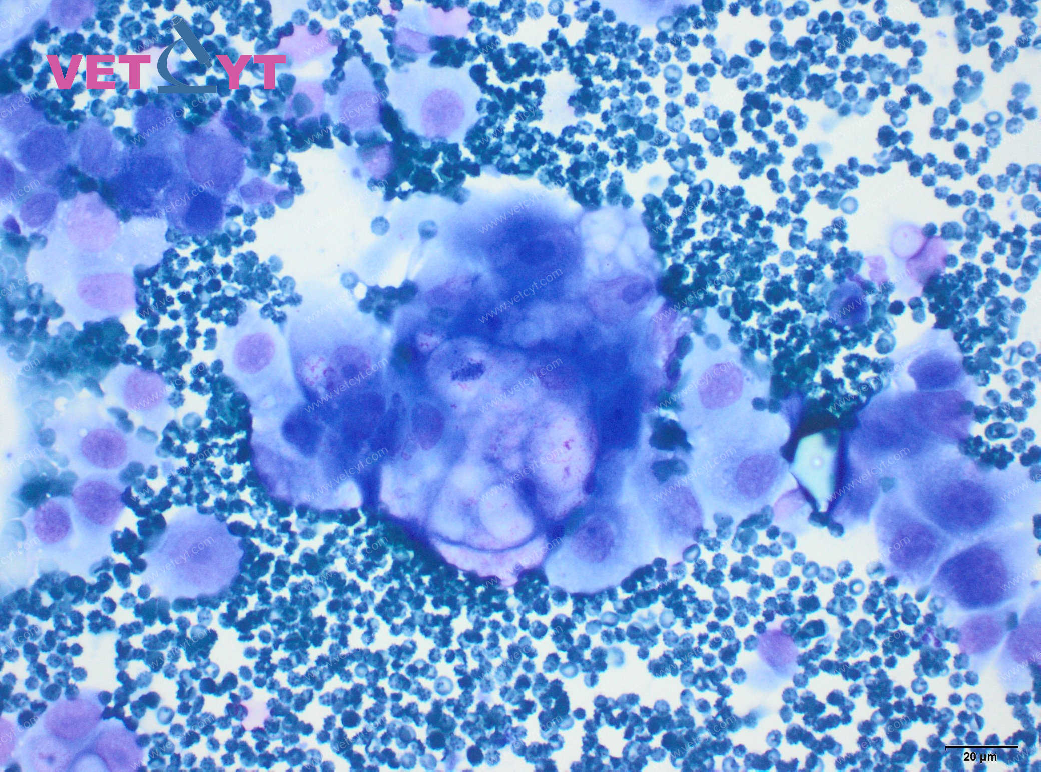 Carcinome à cellules transitionnelles