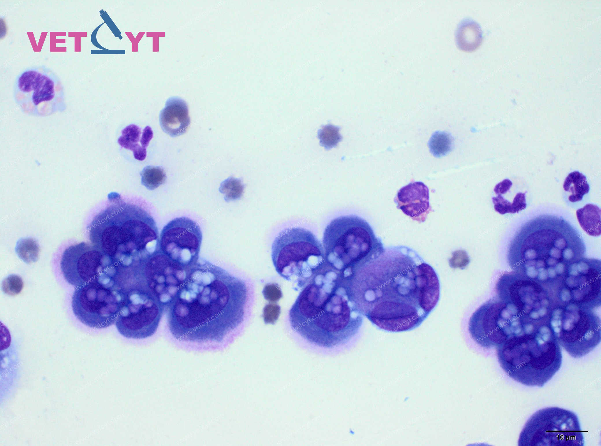 Cellules mésothéliales réactionnelles