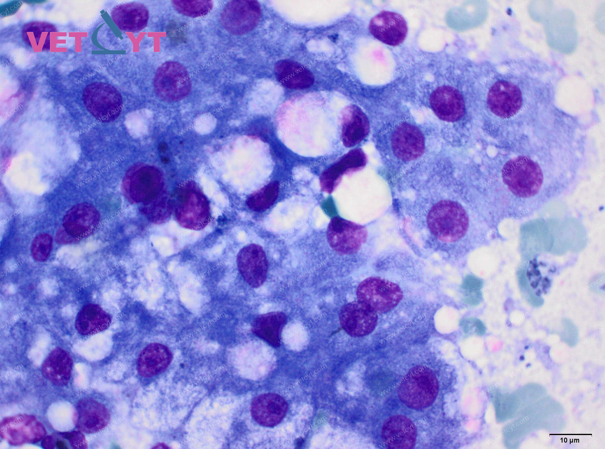 Lipidose hépatique